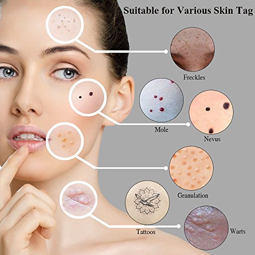 at-danik-medspa-we-offer-skin-tag-and-mole-removal-call-here-s