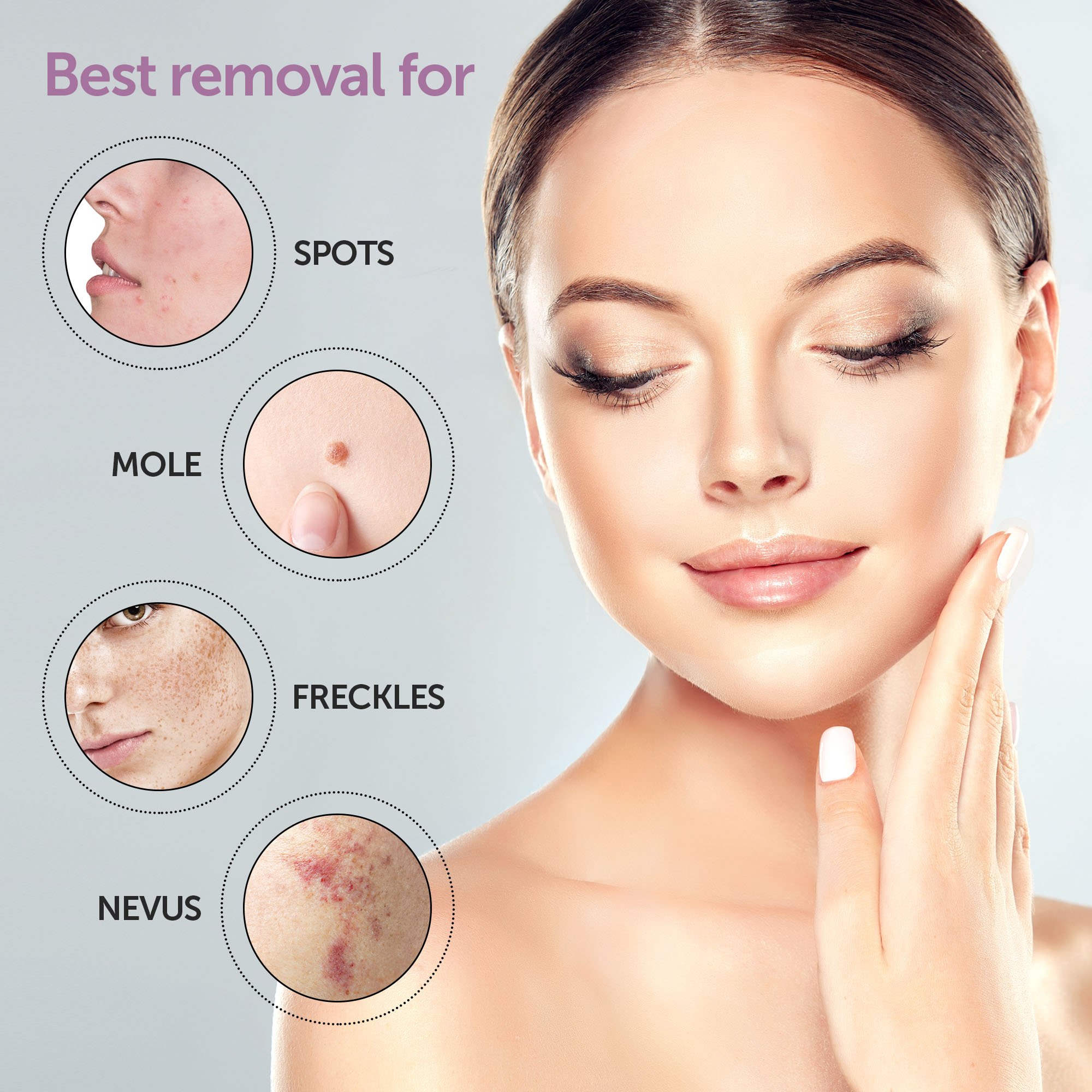 Removing Moles and Skin Tags North York Cosmetic Clinic
