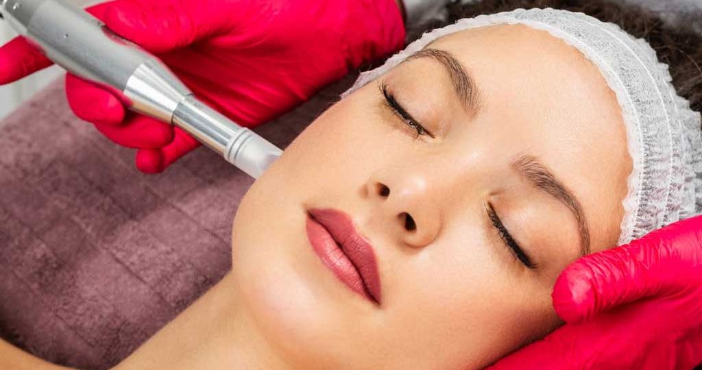 Benefits of Microneedling in North York