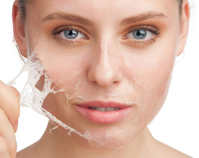 facial-peeling